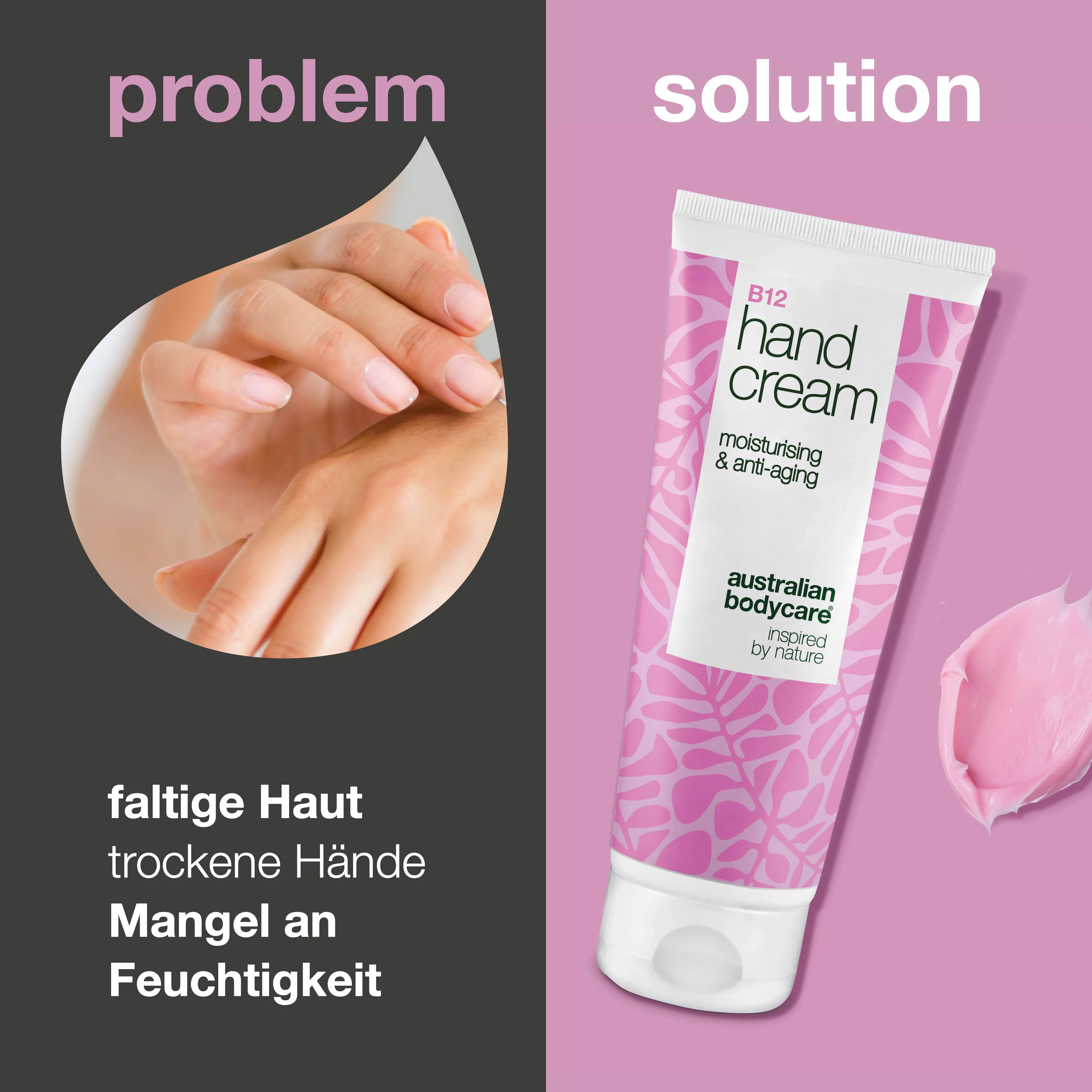B12 Handcreme für trockene, rissige Hände – Feuchtigkeitspflege — B12 Handcreme für glatte, weiche Hände. Reduziert Trockenheit und Falten mit intensiver Feuchtigkeitspflege. - Image 2